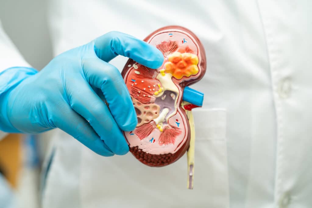 Bisected kidney model.